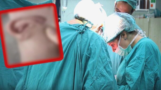 Unusual Surgery in China: Ear Enlarged for 5 Months - RaillyNews