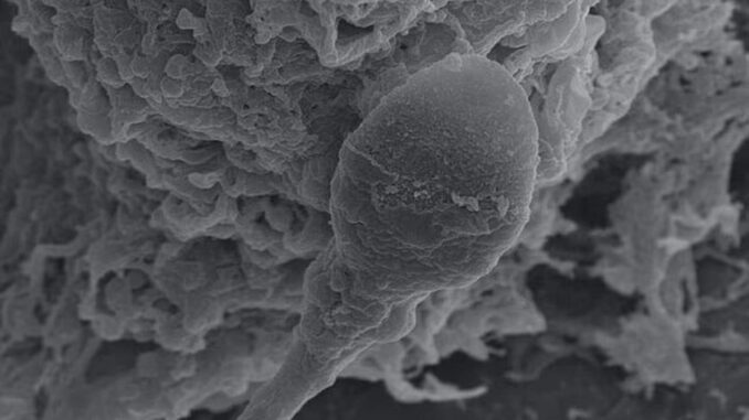 Cosmic Baby Stalemate: Microgravity Disrupts Sperm's Compass - RaillyNews