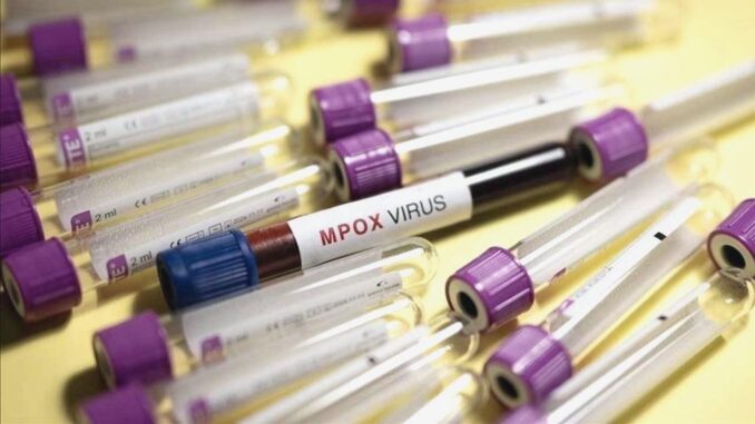 Monkeypox Virus Alert in the USA - RaillyNews